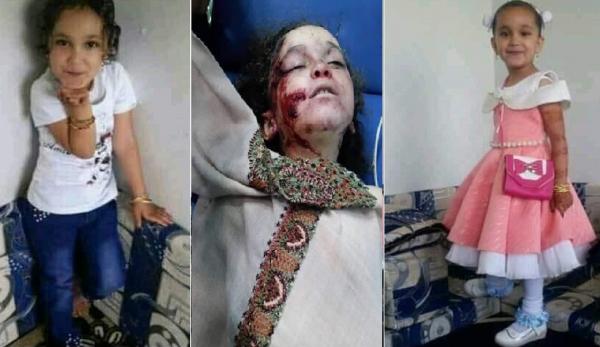 جريمة وقصة مقتل الطفلة ريماس القادري في إب وغياب تام للمنظمات الانسانية