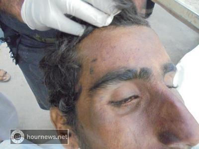 تعذيب شاب بالصعق بالكهرباء حتى الموت في محافظة مأرب (صور )